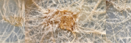 Metabolic Reprogramming during Plant-Microbe Interactions