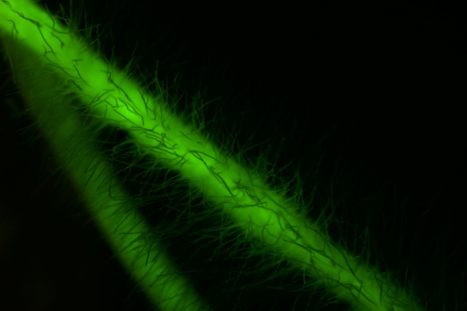 Metabolic Reprogramming during Plant-Microbe Interactions